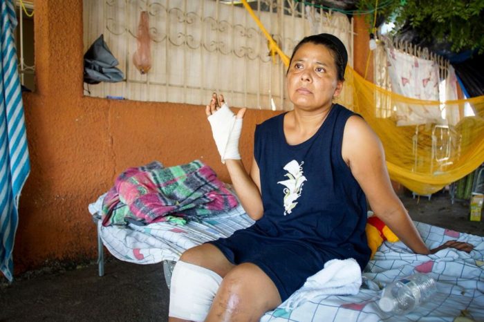 Sobreviviente del sismo duerme en la calle luego de perder a su esposo y tener a su hijo hospitalizado